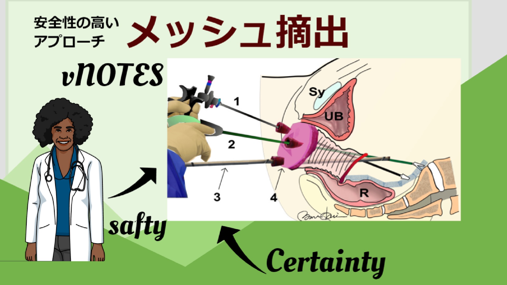 メッシュトラブル