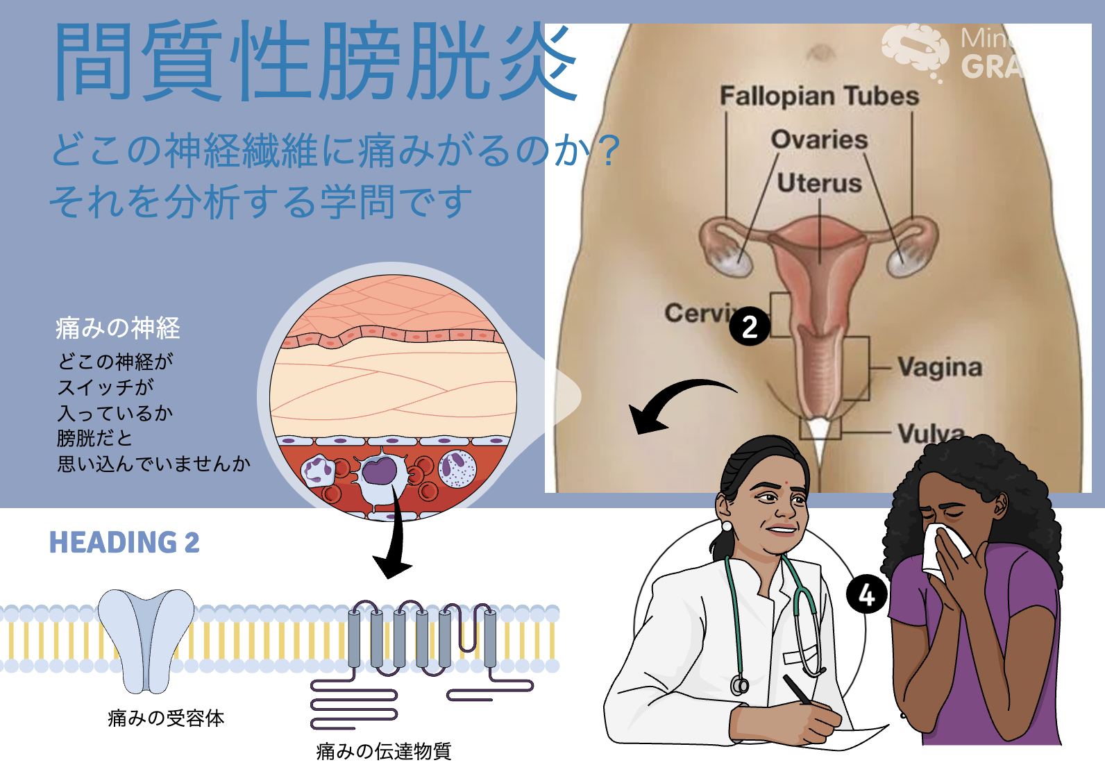 間質性膀胱炎が治らない時にクラスタリングすると痛みの神経が分かる